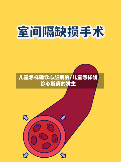 儿童怎样确诊心脏病的/儿童怎样确诊心脏病的发生