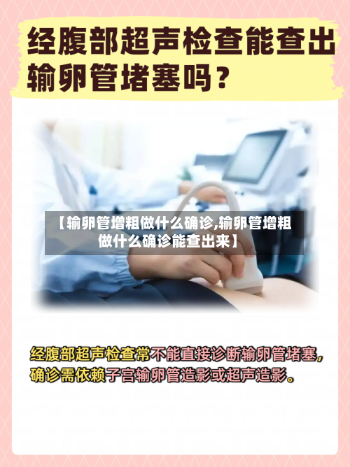 【输卵管增粗做什么确诊,输卵管增粗做什么确诊能查出来】-第2张图片