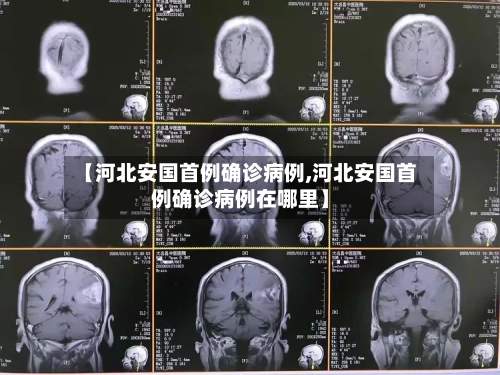 【河北安国首例确诊病例,河北安国首例确诊病例在哪里】