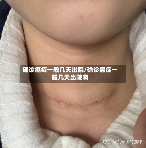 确诊癌症一般几天出院/确诊癌症一般几天出院啊-第3张图片