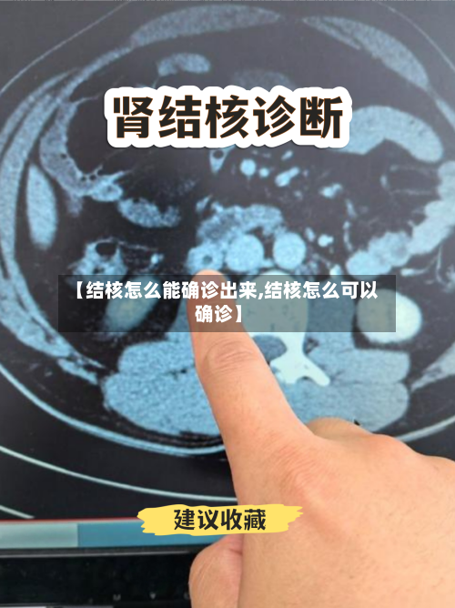 【结核怎么能确诊出来,结核怎么可以确诊】