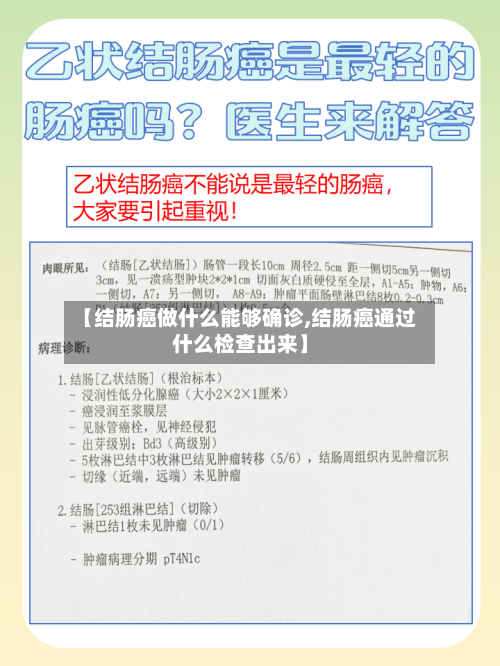 【结肠癌做什么能够确诊,结肠癌通过什么检查出来】