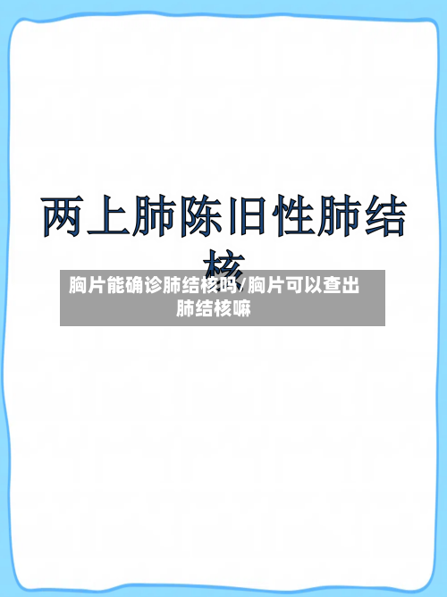 胸片能确诊肺结核吗/胸片可以查出肺结核嘛
