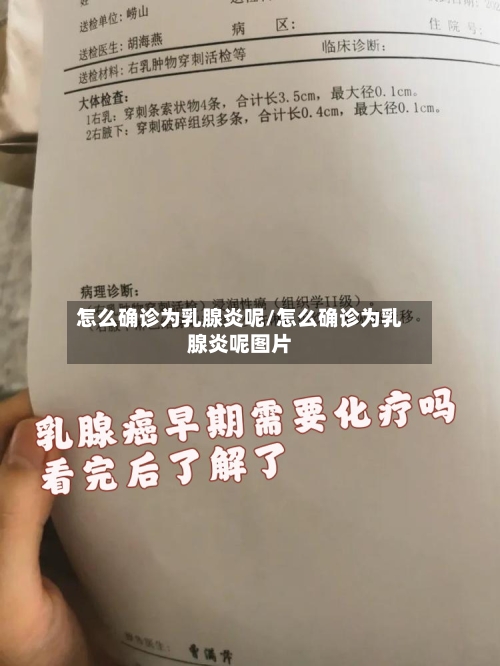 怎么确诊为乳腺炎呢/怎么确诊为乳腺炎呢图片