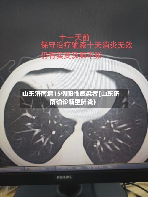 山东济南增15例阳性感染者(山东济南确诊新型肺炎)