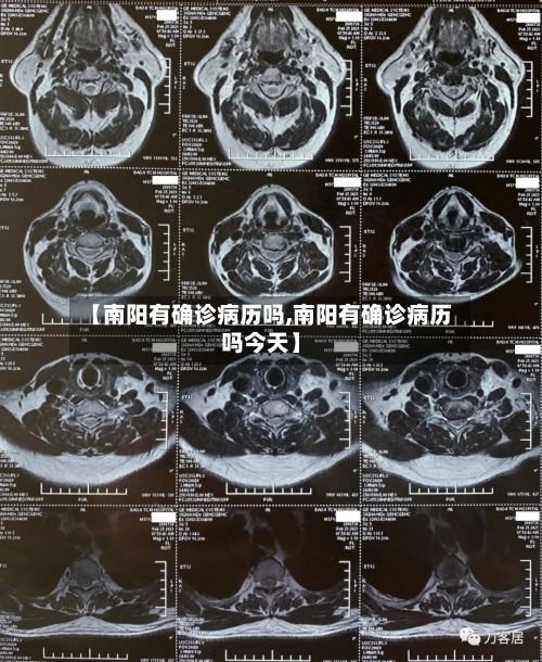 【南阳有确诊病历吗,南阳有确诊病历吗今天】-第3张图片