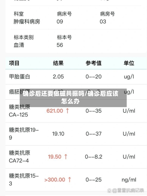 确诊后还要做磁共振吗/确诊后应该怎么办-第2张图片