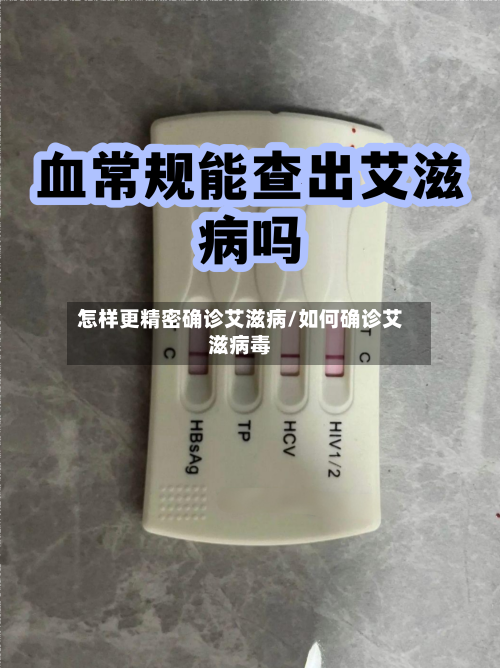 怎样更精密确诊艾滋病/如何确诊艾滋病毒