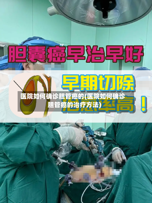 医院如何确诊胆管癌的(医院如何确诊胆管癌的治疗方法)-第2张图片