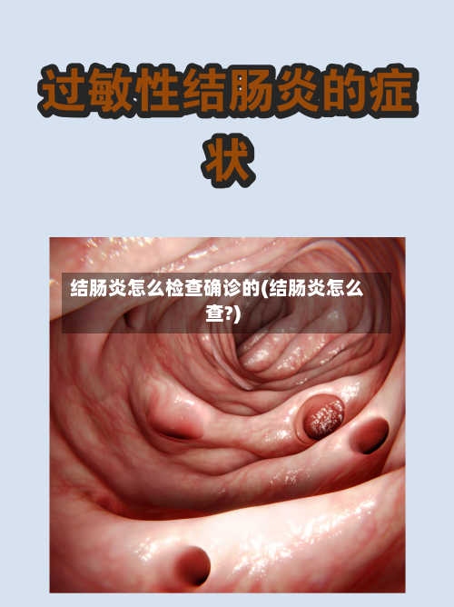 结肠炎怎么检查确诊的(结肠炎怎么查?)