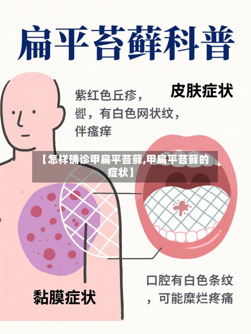 【怎样确诊甲扁平苔藓,甲扁平苔藓的症状】-第3张图片