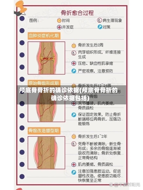 颅底骨骨折的确诊依据(颅底骨骨折的确诊依据包括)