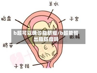 b超可以确诊脂肪瘤/b超能照出脂肪瘤吗