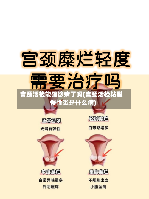宫颈活检能确诊病了吗(宫颈活检粘膜慢性炎是什么病)