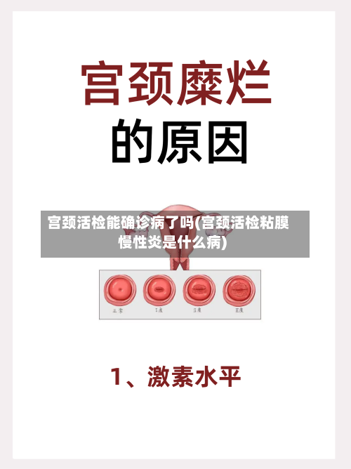 宫颈活检能确诊病了吗(宫颈活检粘膜慢性炎是什么病)-第2张图片