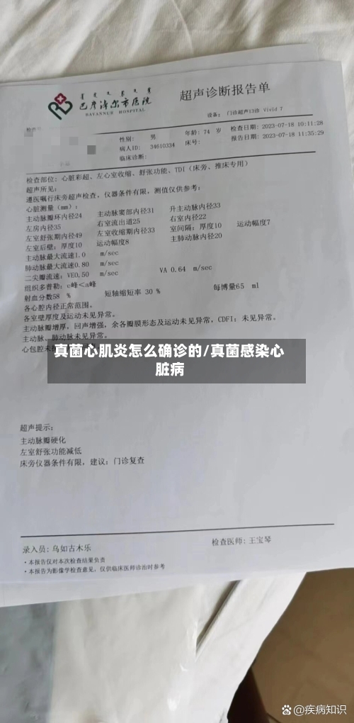 真菌心肌炎怎么确诊的/真菌感染心脏病