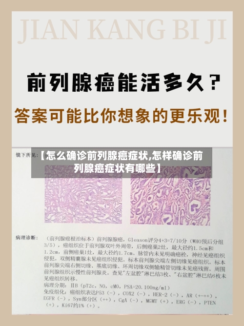 【怎么确诊前列腺癌症状,怎样确诊前列腺癌症状有哪些】