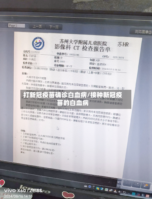 打新冠疫苗确诊白血病/接种新冠疫苗的白血病