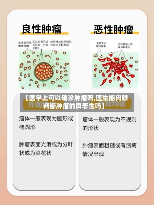 【医学上可以确诊肿瘤吗,医生能肉眼判断肿瘤的良恶性吗】