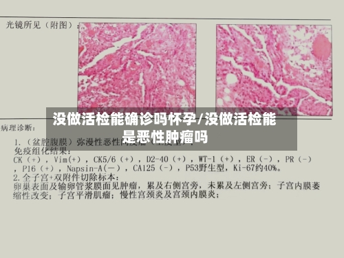 没做活检能确诊吗怀孕/没做活检能是恶性肿瘤吗-第2张图片